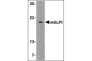 Western blot analysis of SLPI in A-20 cell lysate with this product at 2 μg/ml. (SLPI 抗体  (Center))