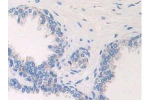 Immunohistochemistry (IHC) image for anti-Electron-Transfer-Flavoprotein, beta Polypeptide (ETFB) (AA 2-255) antibody (ABIN7440638)