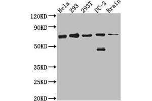 Western Blot Positive WB detected in: Hela whole cell lysate, 293 whole cell lysate, 293T whole cell lysate, PC-3 whole cell lysate, Mouse Brain whole cell lysate All lanes: LTA4H antibody at 1:1000 Secondary Goat polyclonal to rabbit IgG at 1/50000 dilution Predicted band size: 70, 60, 58, 67 kDa Observed band size: 70 kDa (Recombinant LTA4H 抗体)