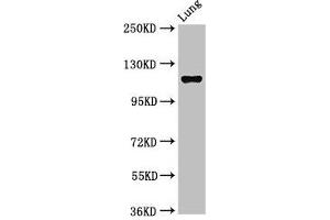Western Blot Positive WB detected in: Rat lung tissue All lanes: MAP3K9 antibody at 2. (MAP3K9 抗体  (AA 864-1098))