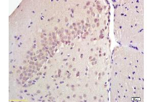 Formalin-fixed and paraffin embedded rat brain labeled with Anti SREBP-1 Polyclonal Antibody, Unconjugated (ABIN686032) at 1:200 followed by conjugation to the secondary antibody and DAB staining (Srebp-1/2 (AA 301-450) 抗体)