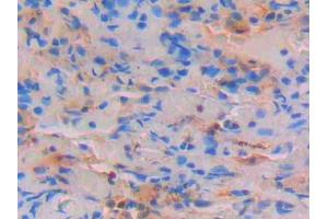 DAB staining on IHC-P; Samples: Human Lung Tissue (STAT4 抗体  (AA 505-737))