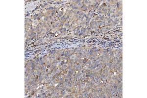 IHC analysis of EIF2AK1 using anti-EIF2AK1 antibody (ABIN7601508).