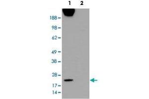 HEK293 overexpressing CAV1 and probed with CAV1 polyclonal antibody  (mock transfection in second lane). (Caveolin-1 抗体  (Internal Region))