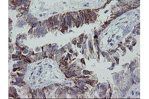 Image no. 1 for anti-Mitochondrial Ribosomal Protein S27 (MRPS27) (AA 151-414) antibody (ABIN1490963) (MRPS27 抗体  (AA 151-414))
