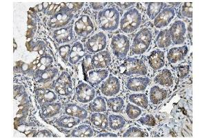 IHC analysis of Clathrin heavy chain/CLTC using anti-Clathrin heavy chain/CLTC antibody (ABIN7602704). (Clathrin Heavy Chain (CLTC) (AA 967-1668) 抗体)