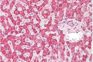 Immunohistochemistry (IHC) image for anti-Phospholipase A2, Group IIA (Platelets, Synovial Fluid) (PLA2G2A) (Internal Region) antibody (ABIN2613468)