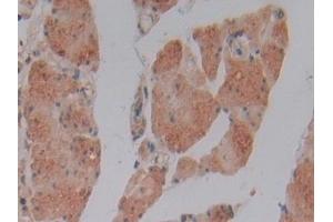 Immunohistochemistry (IHC) image for anti-Glutathione S-Transferase mu 4 (GSTM4) (AA 18-215) antibody (ABIN7439909)