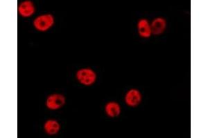 ABIN6277201 staining HepG2 by IF/ICC. (Histone 3 抗体  (H3K36me))