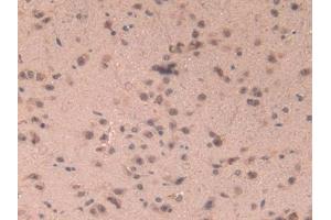 DAB staining on IHC-P; Samples: Mouse Brain Tissue (CCL6 抗体  (AA 22-116))