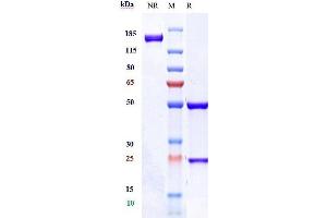 Anti-TSPAN26 / CD37 Reference Antibody (AGS67E) on SDS-PAGE under reducing (R) condition.