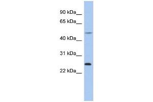 WB Suggested Anti-CTRB1 Antibody Titration:  0. (CTRB1 抗体  (N-Term))