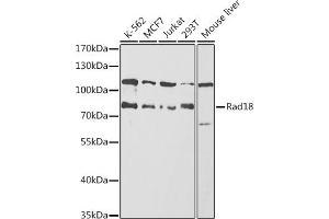 Western blot analysis of extracts of various cell lines, using Rad18 antibody (ABIN6128609, ABIN6146628, ABIN6146630 and ABIN6217430) at 1:1000 dilution. (RAD18 抗体  (AA 216-495))