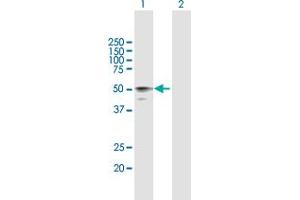 Western Blot analysis of HYAL3 expression in transfected 293T cell line by HYAL3 MaxPab polyclonal antibody. (HYAL3 抗体  (AA 1-417))