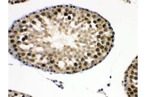 IHC testing of FFPE rat testis with EIF3A antibody.