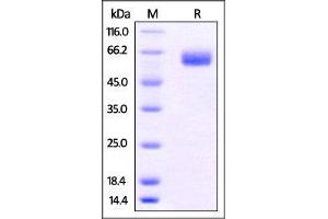 Human B7-H5, Fc Tag on SDS-PAGE under reducing (R) condition. (VTCN1 Protein (AA 33-194) (Fc Tag))