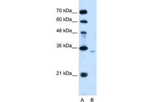 Western Blotting (WB) image for anti-Phosphatidic Acid Phosphatase Type 2A (PPAP2A) antibody (ABIN2462534)