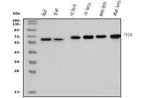 Western blot analysis of SPAK/STK39 using anti-SPAK/STK39 antibody (ABIN7601373).