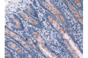 Figure. (OAS1 抗体  (AA 139-358))