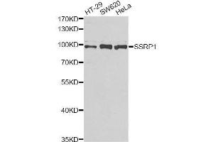 Western blot analysis of extracts of various cell lines, using SSRP1 antibody. (SSRP1 抗体  (AA 1-300))