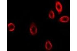 Immunofluorescent analysis of GAMT staining in U2OS cells. (GAMT 抗体)