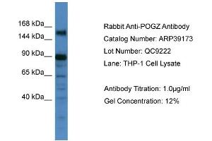 WB Suggested Anti-POGZ Antibody   Titration: 1. (POGZ 抗体  (C-Term))