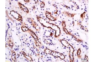 Paraformaldehyde-fixed, paraffin embedded human kidney, Antigen retrieval by boiling in sodium citrate buffer (pH6) for 15min, Block endogenous peroxidase by 3% hydrogen peroxide for 30 minutes, Blocking buffer (normal goat serum) at 37°C for 20min, Antibody incubation with Rabbit Anti-APOA1 Polyclonal Antibody, Unconjugated  at 1:200 overnight at 4°C, followed by a conjugated secondary for 90 minutes and DAB staining. (APOA1 抗体  (AA 51-150))