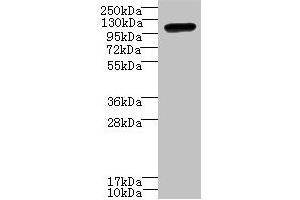 Western blot All lanes: STOX1 antibody at 8 μg/mL + HepG2 whole cell lysate Secondary Goat polyclonal to rabbit IgG at 1/10000 dilution Predicted band size: 111, 26, 20 kDa Observed band size: 111 kDa (STOX1 抗体  (AA 559-858))