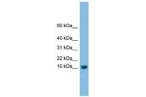 C13orf30 antibody used at 1 ug/ml to detect target protein. (C13orf30 抗体  (N-Term))