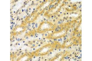 Immunohistochemistry of paraffin-embedded Mouse kidney using ADCK3 Polyclonal Antibody at dilution of 1:100 (40x lens). (COQ8A 抗体)
