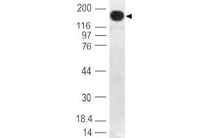Image no. 1 for anti-DNA (Cytosine-5)-Methyltransferase 1 (DNMT1) (AA 128-429) antibody (ABIN5027163) (DNMT1 抗体  (AA 128-429))
