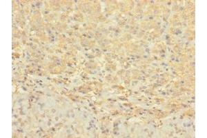 Immunohistochemistry of paraffin-embedded human adrenal gland tissue using ABIN7148072 at dilution of 1:100 (CCDC113 抗体  (AA 1-200))