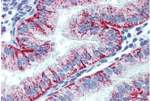 Human Uterus (formalin-fixed, paraffin-embedded) stained with HSPD1 antibody ABIN462364 followed by biotinylated anti-mouse IgG secondary antibody ABIN481714, alkaline phosphatase-streptavidin and chromogen. (HSPD1 抗体)