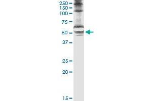 Immunoprecipitation of STK25 transfected lysate using anti-STK25 monoclonal antibody and Protein A Magnetic Bead , and immunoblotted with STK25 monoclonal antibody. (STK25 抗体  (AA 321-426))