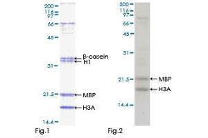 Kinase Activity Assay (KAA) image for serine/threonine Kinase 32C (STK32C) (AA 1-369) protein (GST tag) (ABIN1321692)