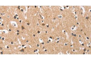 Immunohistochemistry of paraffin-embedded Human brain using DKK3 Polyclonal Antibody at dilution of 1:50 (DKK3 抗体)