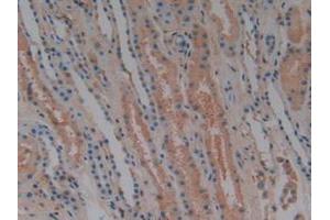 IHC-P analysis of Human Kidney Tissue, with DAB staining. (Complement Factor H 抗体  (AA 860-1231))