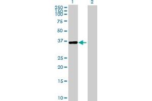 Western Blot analysis of IREB2 expression in transfected 293T cell line by IREB2 MaxPab polyclonal antibody.