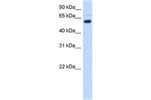 WB Suggested Anti-CDYL Antibody Titration:  0. (CDYL 抗体  (N-Term))