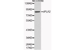 Western Blotting (WB) image for anti-Phospholipase A2, Group IVA (Cytosolic, Calcium-Dependent) (PLA2G4A) (AA 1-180) antibody (ABIN3020971) (PLA2G4A 抗体  (AA 1-180))