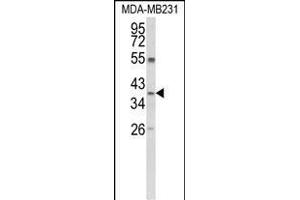 Western blot analysis of ARG1 Antibody (C-term) (ABIN652925 and ABIN2842593) in MDA-M cell line lysates (35 μg/lane).
