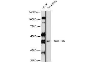Immunofluorescence analysis of U-2 OS cells using NOSTRIN Rabbit pAb (ABIN7268922) at dilution of 1:100 (40x lens). (NOSTRIN 抗体  (AA 207-506))