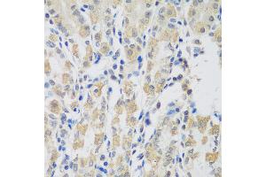Immunohistochemistry of paraffin-embedded human stomach using VPS4A antibody (ABIN5974267) at dilution of 1/100 (40x lens). (VPS4A 抗体)