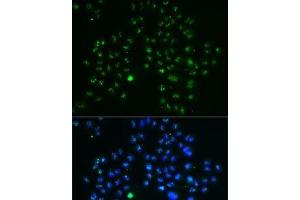 Immunofluorescence analysis of MCF7 cells using GNL3 Polyclonal Antibody (Nucleostemin 抗体)