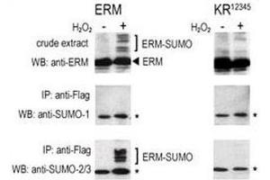 COS-7 cells were transfected for 24 hrs with a plasmid expressing FLAG-ERM (left panels) or FLAG-ERM KR12345 (right panels). (SUMO1 抗体  (AA 55-86))