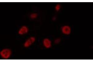 ABIN6274462 staining LOVO cells by IF/ICC. (FOXJ1 抗体  (Internal Region))