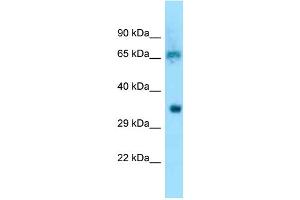 WB Suggested Anti-Eif3d Antibody Titration: 1.