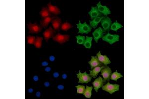 KIAA1522 Antibody staining HepG2 cells by IF/ICC. (KIAA1522 抗体)