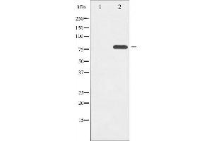 Western blot analysis of ETK phosphorylation expression in Serum treated HeLa whole cell lysates,The lane on the left is treated with the antigen-specific peptide. (BMX 抗体  (pTyr566))