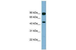 AGK antibody used at 1 ug/ml to detect target protein. (Acylglycerol Kinase 抗体  (N-Term))